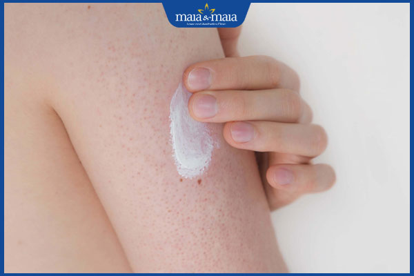 bôi thuốc trị dày sừng nang lông