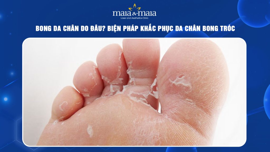 Bong da chân do đâu? Biện pháp khắc phục da chân bong tróc 1 bong da chân