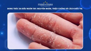 bong tróc da đầu ngón tay