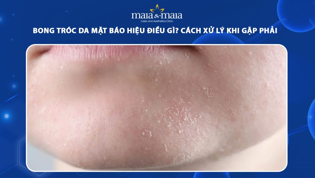 bong tróc da mặt