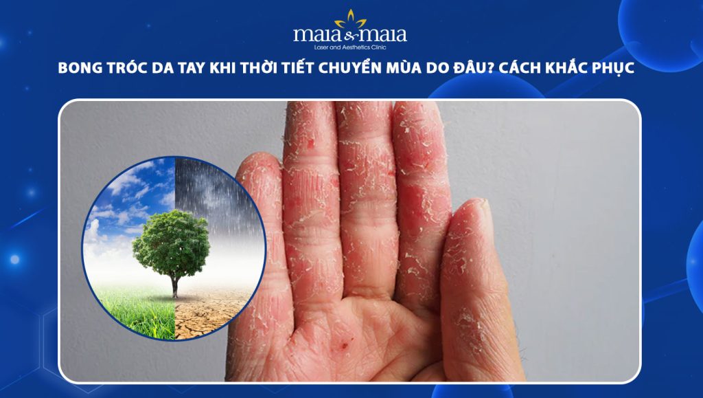bong tróc da tay khi thời tiết chuyển mùa