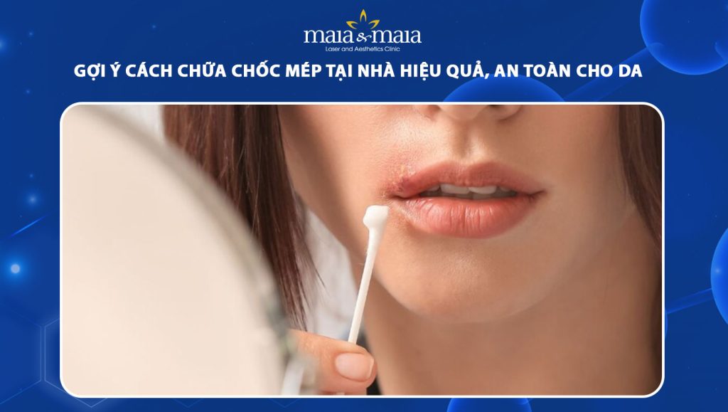 cách chữa chốc mép tại nhà