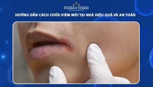cách chữa viêm môi tại nhà