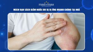 cách giảm ngứa khi bị dị ứng