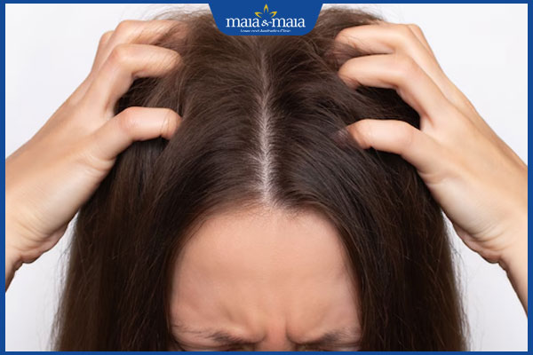 Cảm giác có côn trùng bò trên tóc là bị làm sao? Cách xử lý 2 cảm giác ngứa ngáy khó chịu