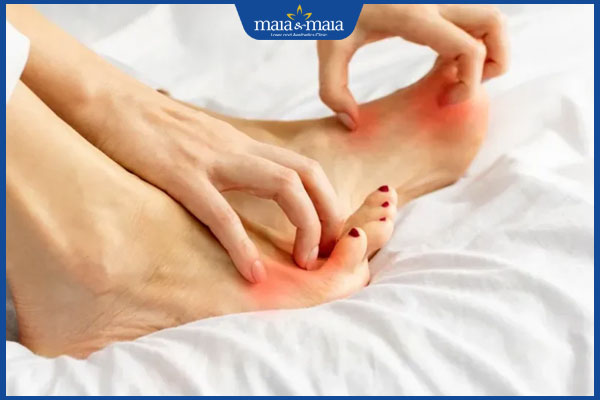 chân ngứa nhiều