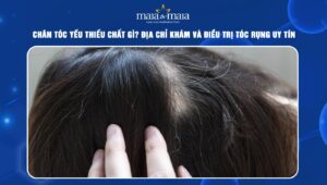 chân tóc yếu thiếu chất gì