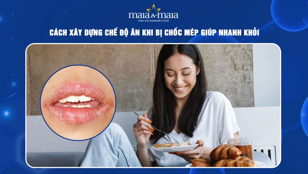 Cách xây dựng chế độ ăn khi bị chốc mép giúp nhanh khỏi 1 chế độ ăn khi bị chốc mép