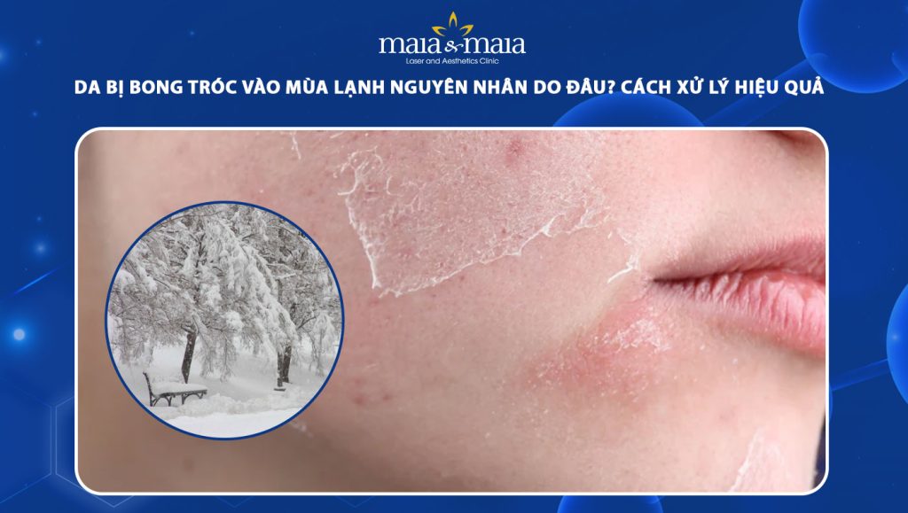 da bị bong tróc vào mùa lạnh