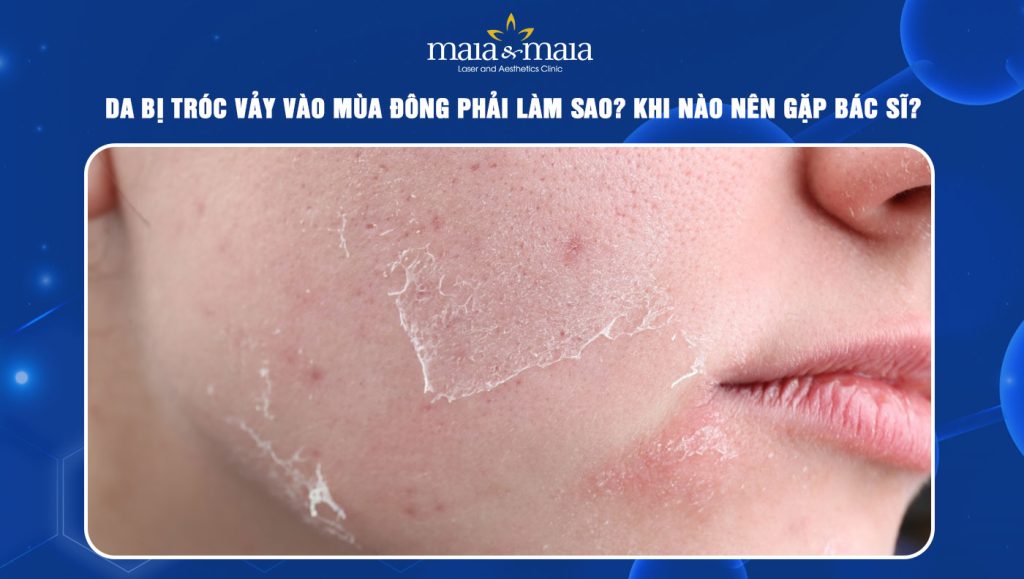 Da bị tróc vảy vào mùa đông