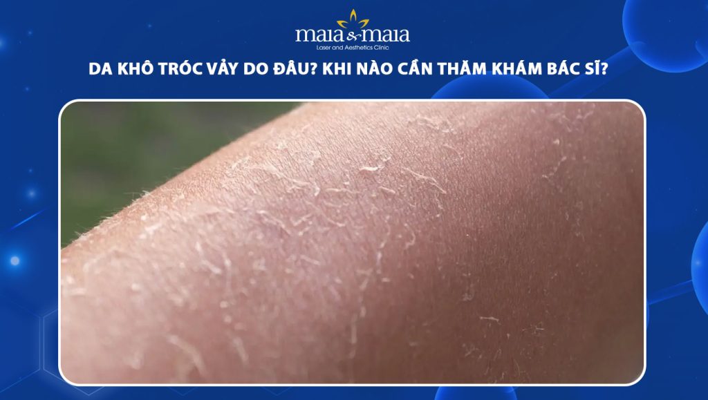 da khô tróc vảy