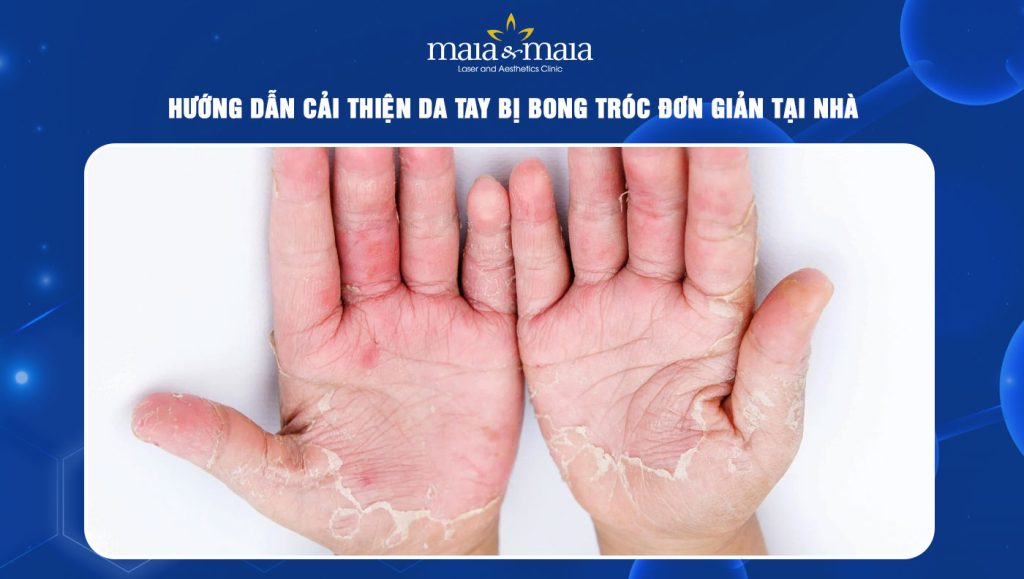 da tay bị bong tróc