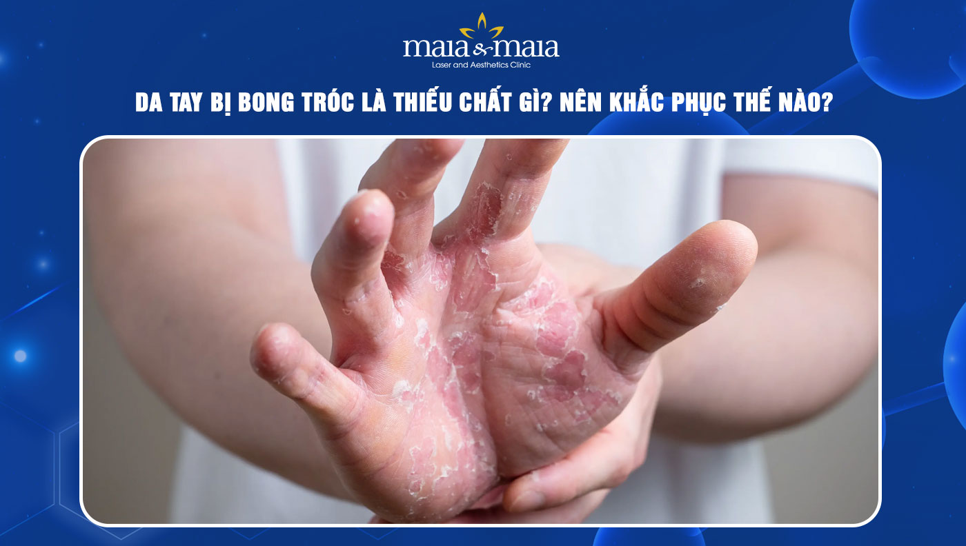 da tay bị bong tróc là thiếu chất gì