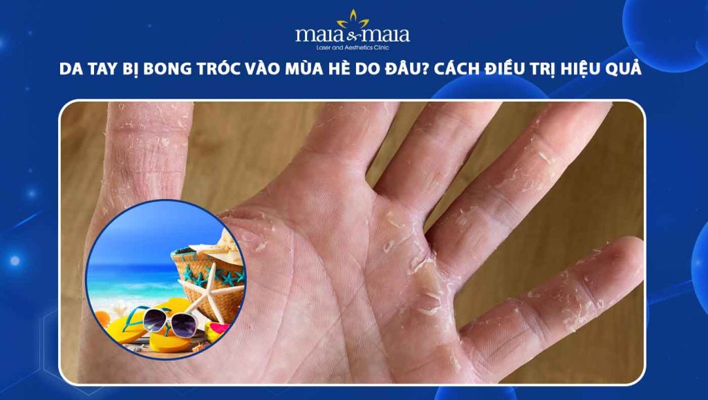 da tay bị bong tróc vào mùa hè