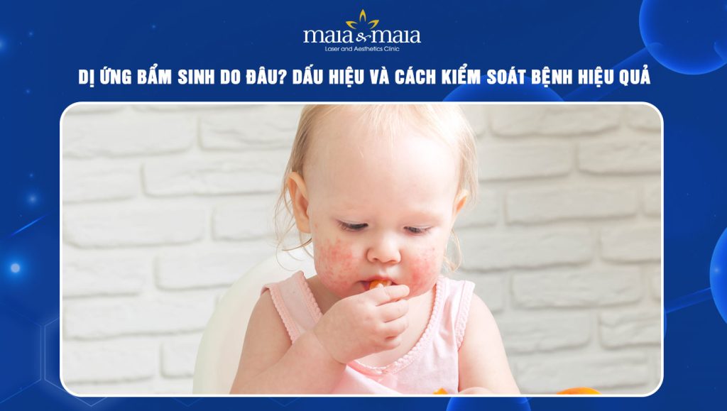 Dị ứng bẩm sinh