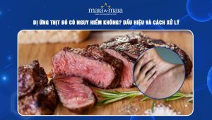 dị ứng thịt bò