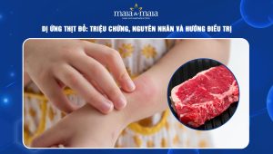 Dị ứng thịt đỏ