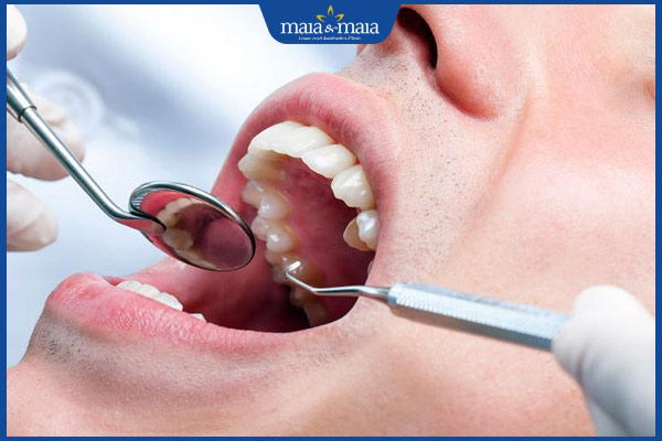 điều trị nha khoa