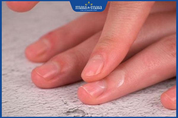 dưỡng ẩm da đầu ngón tay