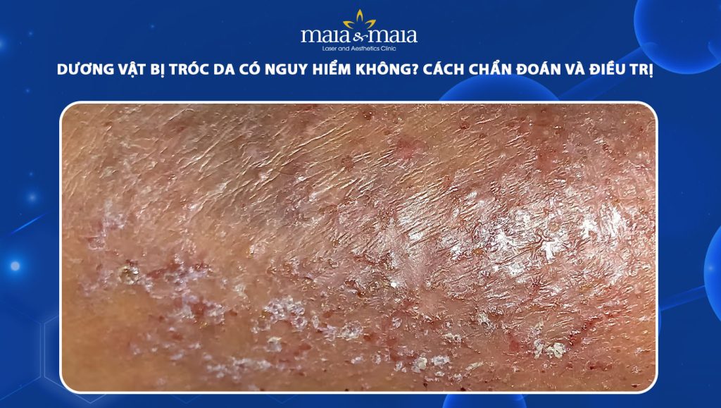 dương vật bị tróc da