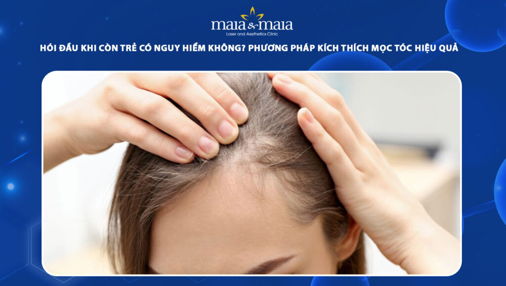 hói đầu khi còn trẻ