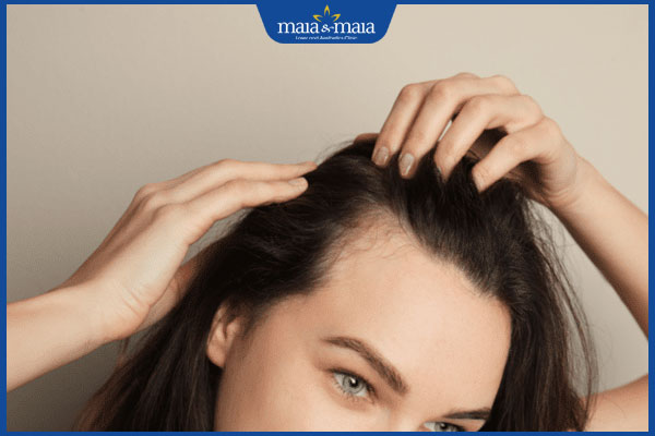 hói đầu lúc trẻ