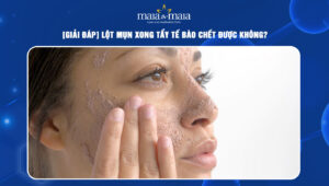 lột mụn xong tẩy tế bào chết được không
