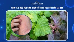 mẹo dân gian chữa sốt phát ban