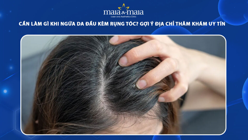 ngứa da đầu kèm rụng tóc