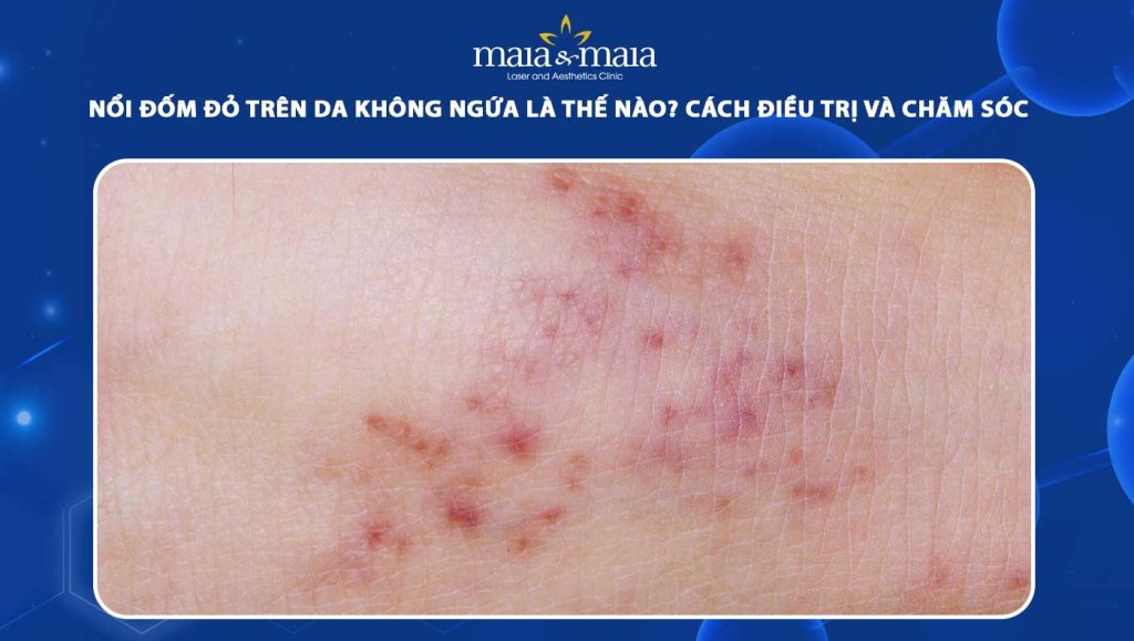 nổi đốm đỏ trên da không ngứa
