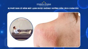 bị phát ban có nằm máy lạnh được không
