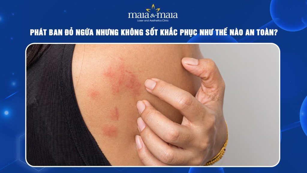 phát ban đỏ ngứa nhưng không sốt