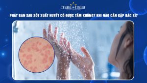 phát ban sau sốt xuất huyết có được tắm không