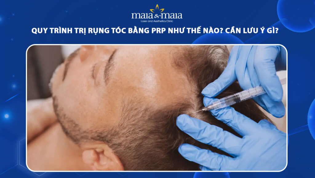 Quy trình trị rụng tóc bằng PRP như thế nào? Cần lưu ý gì? 1 quy trình trị rụng tóc bằng prp