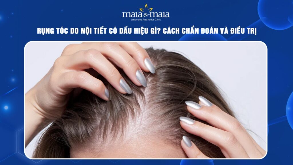 Rụng tóc do nội tiết có dấu hiệu gì? Chẩn đoán và điều trị 1 rụng tóc do nội tiết