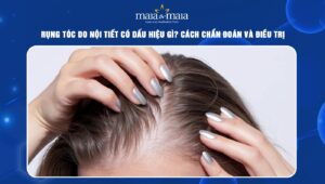 rụng tóc do nội tiết