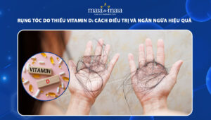 rụng tóc do thiếu vitamin d