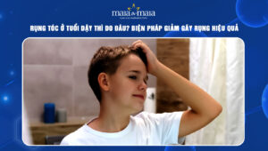 rụng tóc ở tuổi dậy thì