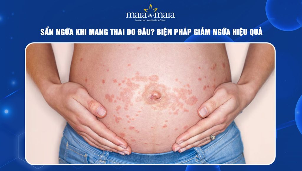 sẩn ngứa khi mang thai