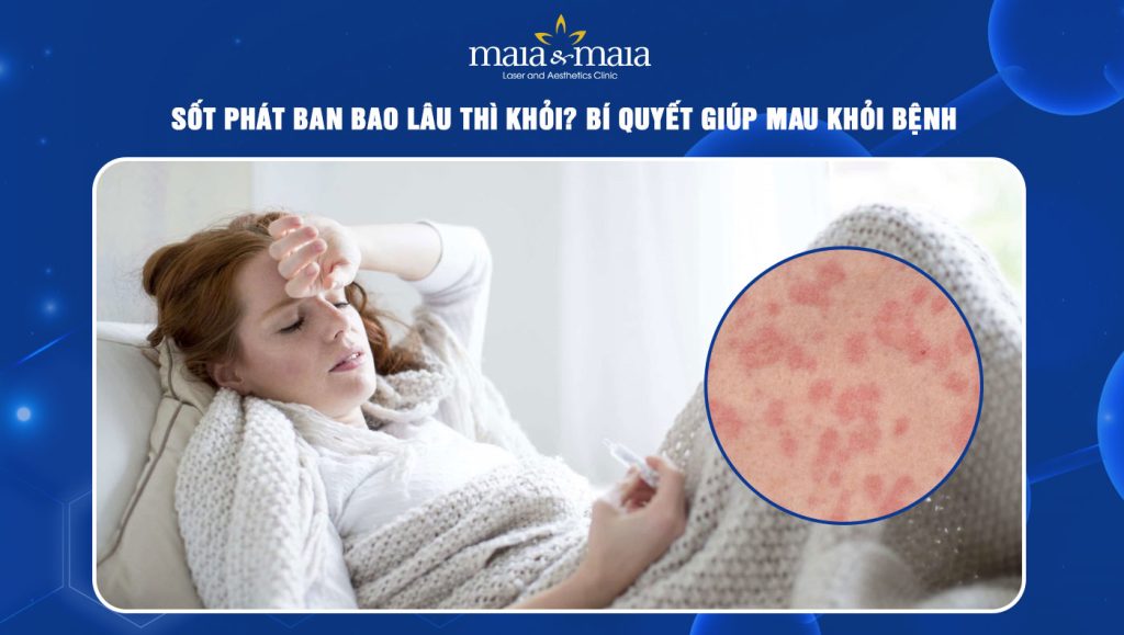 sốt phát ban bao lâu thì khỏi