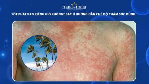 sốt phat ban kiêng gió không