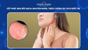 sốt phát ban nổi hạch