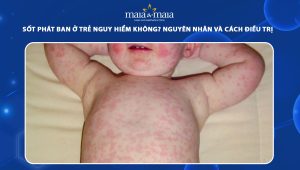 sốt phát ban ở trẻ