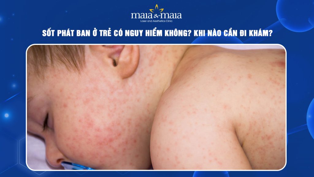 sốt phát ban ở trẻ có nguy hiểm không