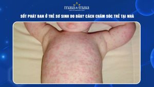 Sốt phát ban ở trẻ sơ sinh