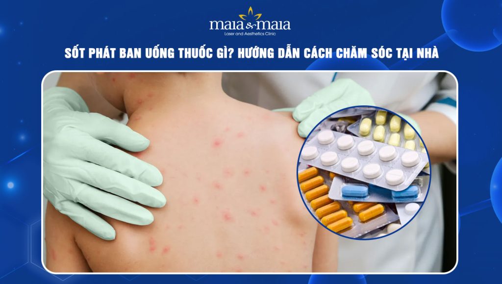 sốt phát ban uống thuốc gì