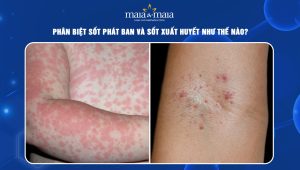 sốt phát ban và sốt xuất huyết