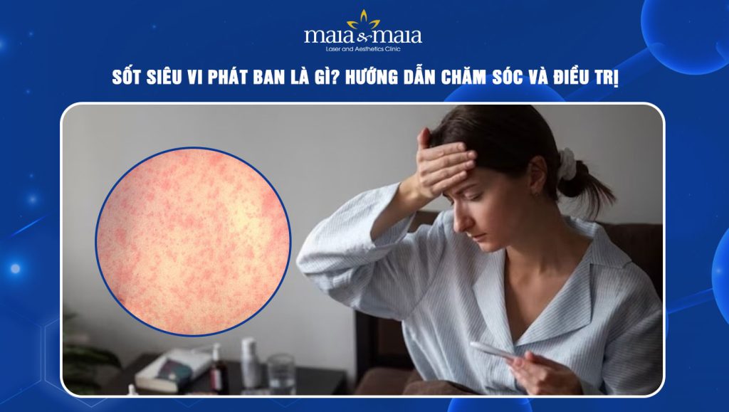Sốt siêu vi phát ban