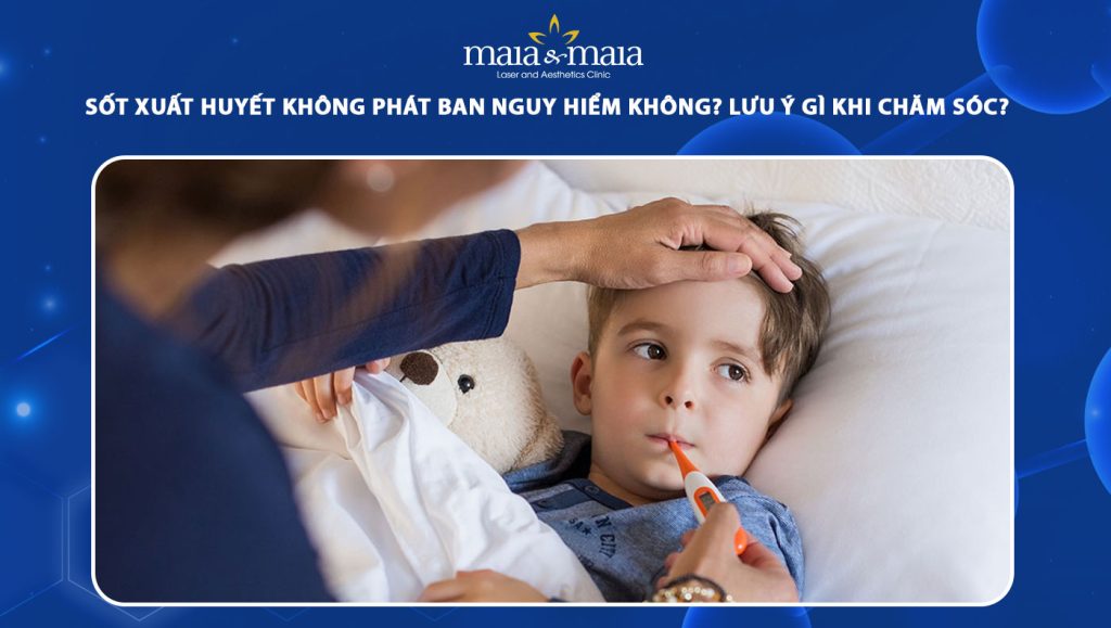 sốt xuất huyết không phát ban