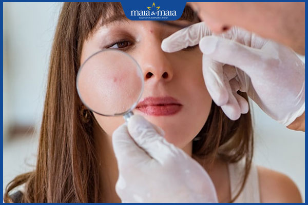 thăm khám bệnh demodex